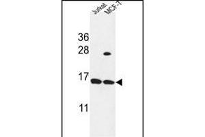 SPRR1A Antibody (C-term) (ABIN653515 and ABIN2842918) western blot analysis in Jurkat,MCF-7 cell line lysates (35 μg/lane). (SPRR1A 抗体  (C-Term))