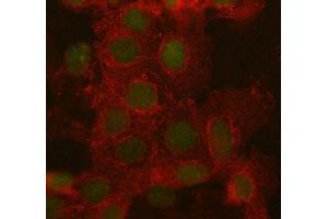 IF analysis of ARID1A using anti-ARID1A antibody (ABIN7602567) and anti-Beta Tubulin antibody (ABIN7602743).
