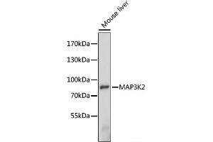 Western blot analysis of extracts of Mouse liver using MAP3K2 Polyclonal Antibody at dilution of 1:1000. (MAP3K2 抗体)