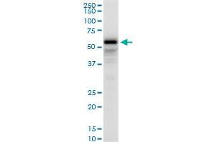 PDLIM5 polyclonal antibody (A02), Lot # NNR0051021QC01. (PDLIM5 抗体  (AA 1-596))