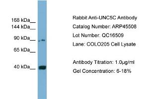 WB Suggested Anti-UNC5C  Antibody Titration: 0. (Unc5c 抗体  (Middle Region))