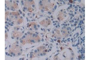 Detection of GZMB in Human Stomach Tissue using Polyclonal Antibody to Granzyme B (GZMB) (GZMB 抗体  (AA 21-247))