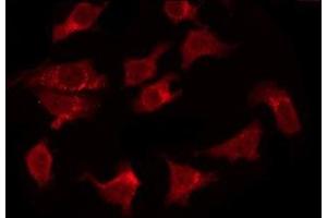 ABIN6277861 staining HeLa by IF/ICC. (FADD 抗体  (N-Term))