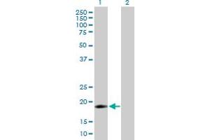 Western Blot analysis of IFNA16 expression in transfected 293T cell line by IFNA16 MaxPab polyclonal antibody. (IFNA16 抗体  (AA 1-189))