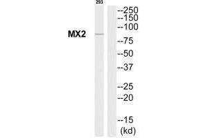 Western blot analysis of extracts from 293 cells, using MX2 antibody. (MX2 抗体)