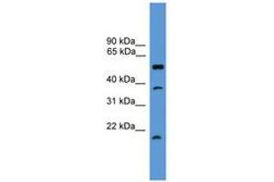 Image no. 1 for anti-serine Peptidase Inhibitor, Kunitz Type, 2 (SPINT2) (AA 91-140) antibody (ABIN6746573) (SPINT2 抗体  (AA 91-140))