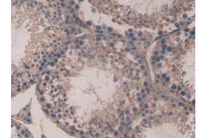 DAB staining on IHC-P; Samples: Mouse Testis Tissue (SPTAN1 抗体  (AA 1605-1806))