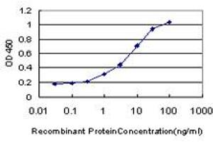 Detection limit for recombinant GST tagged PBX1 is approximately 0. (PBX1 抗体  (AA 213-321))