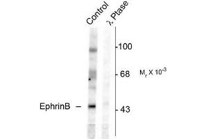 Image no. 1 for anti-Ephrin B1 (EFNB1) (pTyr331) antibody (ABIN372621) (Ephrin B1 抗体  (pTyr331))