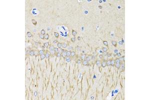 Immunohistochemistry of paraffin-embedded mouse brain using MAP1LC3B antibody.