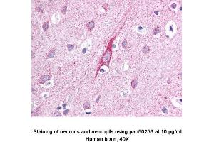 Image no. 1 for anti-ATPase Type 13A2 (ATP13A2) (AA 200-300), (Internal Region) antibody (ABIN363562)