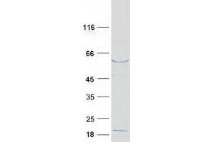 Western Blotting (WB) image for F-Box and WD Repeat Domain Containing 11 (FBXW11) (Transcript Variant 2) protein (Myc-DYKDDDDK Tag) (ABIN2720929)