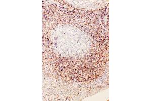 Anti-Diubiquitin antibody, IHC(P) IHC(P): Human Tonsil Tissue (UBD 抗体  (N-Term))