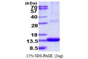 SDS-PAGE (SDS) image for ADP-Ribosylation Factor-Like 9 (ARL9) (AA 1-123) protein (His tag) (ABIN667994) (ARL9 Protein (AA 1-123) (His tag))