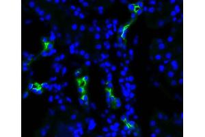 Immunohistochemistry analysis using Rabbit Anti-Aquaporin 2 Polyclonal Antibody . (AQP2 抗体  (C-Term) (FITC))