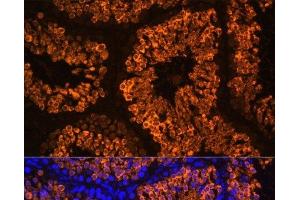 Immunofluorescence analysis of Mouse testis using LDHC Polyclonal Antibody at dilution of 1:100 (40x lens). (Lactate Dehydrogenase C 抗体)