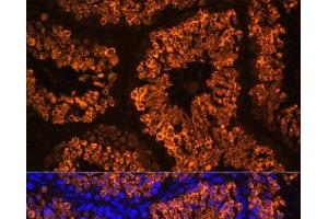 Immunofluorescence analysis of Mouse testis using LDHC Polyclonal Antibody at dilution of 1:100 (40x lens).