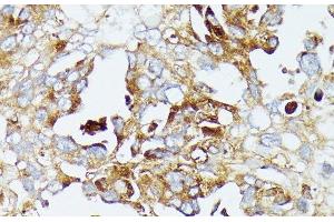 Immunohistochemistry (Paraffin-embedded Sections) (IHC (p)) image for anti-Cytochrome C Oxidase Assembly Homolog 15 (COX15) antibody (ABIN7258036)