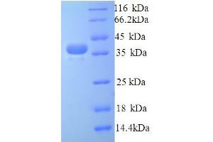 SDS-PAGE (SDS) image for Talin 1 (TLN1) (AA 92-399), (partial) protein (His tag) (ABIN5714532) (TLN1 Protein (AA 92-399, partial) (His tag))