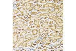 Immunohistochemistry of paraffin-embedded mouse kidney using PIK3CA Rabbit pAb (ABIN6134411, ABIN6145635, ABIN6145637 and ABIN6216129) at dilution of 1:150 (40x lens). (PIK3CA 抗体)