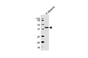 Western Blot at 1:1000 dilution + human placenta lysate Lysates/proteins at 20 ug per lane. (HSD3B1 抗体  (N-Term))
