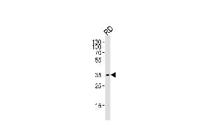 Western blot analysis of lysate from RD cell line,using Cyclin D2 Antibody (Ab-280)(ABIN1450707 and ABIN1450709). (Cyclin D2 抗体)