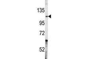 Western blot analysis of c-Abl antibody and A2058 lysate.
