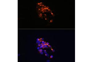 Immunofluorescence analysis of SH-SY5Y cells using Neurofilament M Rabbit mAb (ABIN7268864) at dilution of 1:100 (40x lens). (NEFM 抗体)