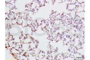 Formalin-fixed and paraffin embedded rat lung tissue labeled with Anti-PAX9 Polyclonal Antibody, Unconjugated (ABIN737691) at 1:200 followed by conjugation to the secondary antibody and DAB staining (PAX9 抗体  (AA 271-341))