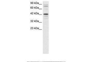 Image no. 1 for anti-SRY (Sex Determining Region Y)-Box 18 (SOX18) (AA 192-241) antibody (ABIN202394) (SOX18 抗体  (AA 192-241))