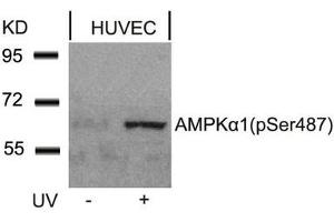 Western blot analysis of extracts from HUVEC cells untreated or treated with UV using AMPKa1(Phospho-Ser487)Antibody. (AMPK alpha 抗体  (pSer487))