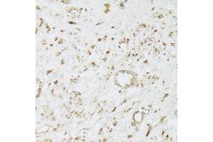 Immunohistochemistry of paraffin-embedded human leiomyoma of uterus using CIAPIN1 Antibody. (CIAPIN1 抗体  (AA 1-312))