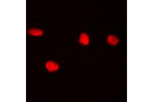 Immunofluorescent analysis of CDC25C (pS216) staining in Hela cells. (CDC25C 抗体  (pSer216))