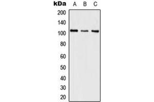 Western blot analysis of SWAP expression in HeLa (A), SP2/0 (B), PC12 (C) whole cell lysates.