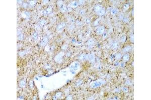 Immunohistochemistry of paraffin-embedded Rat brain using PTGDS Polyclonal Antibody at dilution of 1:200 (40x lens). (PTGDS 抗体)