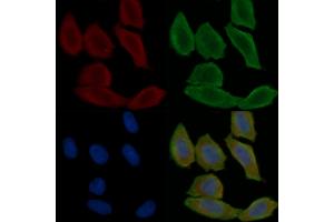 ABIN6260383 and ABIN6279247 staining Hela cells(30 min of UV treatment) by IF/ICC. (CA8 抗体  (C-Term))