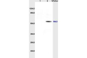 SDS-PAGE (SDS) image for anti-Solute Carrier Family 1 (Glial High Affinity Glutamate Transporter), Member 3 (SLC1A3) (AA 301-400) antibody (ABIN730783)