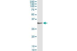 Immunoprecipitation of HOXB1 transfected lysate using anti-HOXB1 monoclonal antibody and Protein A Magnetic Bead , and immunoblotted with HOXB1 MaxPab rabbit polyclonal antibody. (HOXB1 抗体  (AA 101-210))