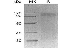 Western Blotting (WB) image for Signal-Regulatory Protein alpha (SIRPA) protein (ABIN7320648) (SIRPA 蛋白)
