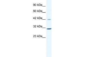 WB Suggested Anti-CCND3 Antibody Titration:  0. (Cyclin D3 抗体  (C-Term))