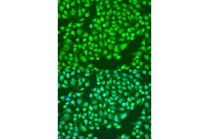 Immunofluorescence analysis of U2OS cells using ITGA2 antibody. (ITGA2 抗体)
