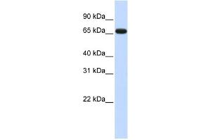 WB Suggested Anti-ZNF775 Antibody Titration: 0. (ZNF775 抗体  (N-Term))