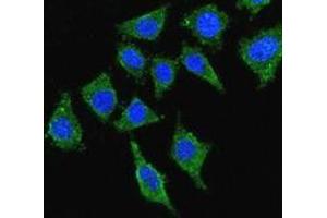 Confocal immunofluorescent analysis with 293 cells using LCAT  Antibody , followed by Alexa Fluor® 488-conjugated goat anti-rabbit lgG (green). (LCAT 抗体  (Middle Region))