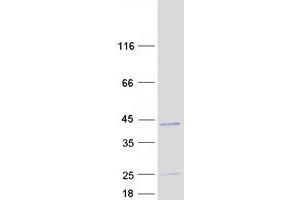 Estrogen Receptor Binding Site Associated, Antigen, 9 (EBAG9) (Transcript Variant 1) protein (Myc-DYKDDDDK Tag)