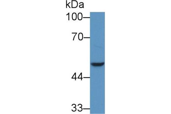 NADK 抗体  (AA 187-426)