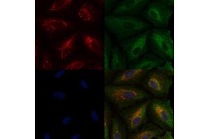 ABIN6259707 and ABIN6276744 staining  cells by IF/ICC. (ABO 抗体  (N-Term))