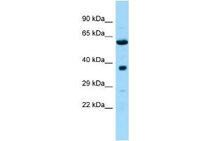 Host: Rabbit Target Name: Ndufa10l1 Sample Type: Rat Pancreas lysates Antibody Dilution: 1. (NDUFA10L1 抗体  (C-Term))