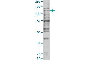 Western Blotting (WB) image for anti-Tripartite Motif Containing 24 (TRIM24) (AA 432-569) antibody (ABIN599067) (TRIM24 抗体  (AA 432-569))