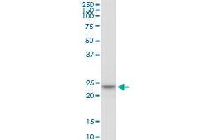 NOP16 MaxPab polyclonal antibody. (NOP16 抗体  (AA 1-178))