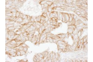Immunohistochemistry (IHC) image for anti-Adducin 1 (Alpha) (ADD1) (AA 632-682) antibody (ABIN7454952)